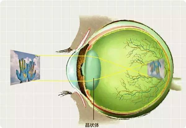 近视眼成因